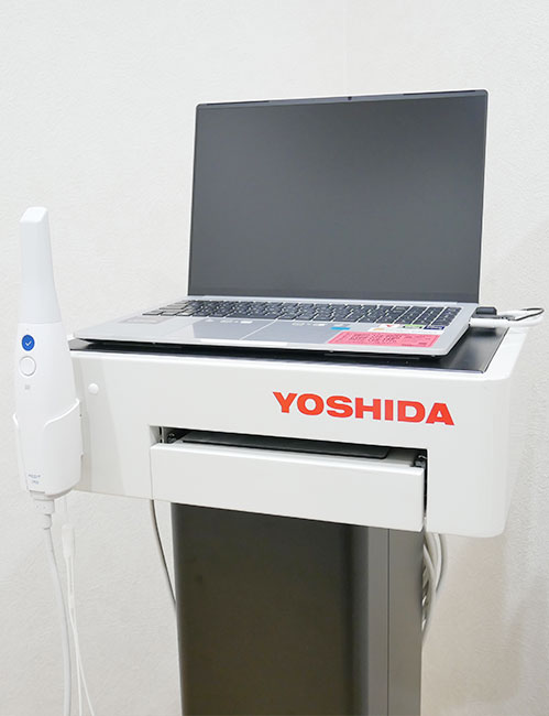 ３D光学スキャナー